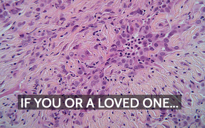 Mesothelioma, Asbestos, and the Fight for Clean Air in the Workplace