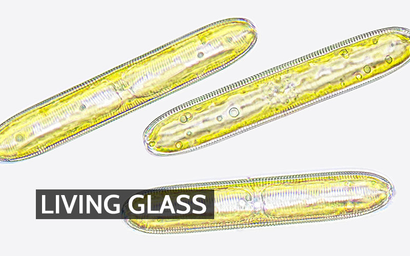 A microscope view of three diatom cells