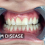 Pollution Beyond the Lungs: How Air Quality May Affect Gum Health